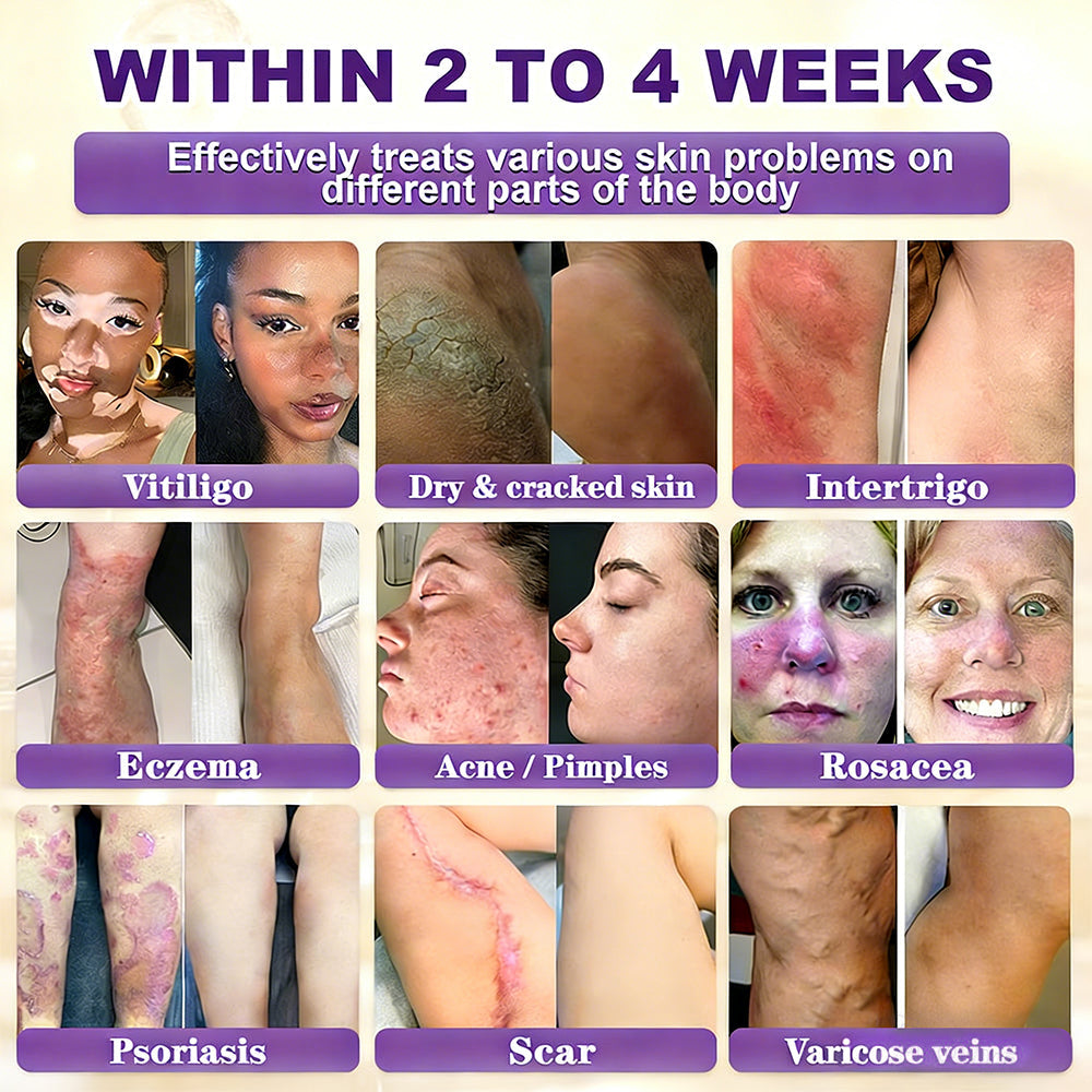 ✨Alisanda® Biotin 10-in-1 Skin Restoration Cream 🌙
