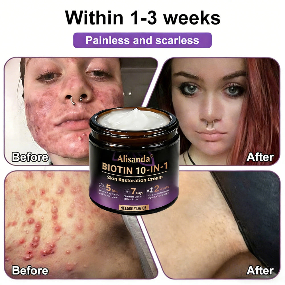 ✨Alisanda® Biotin 10-in-1 Skin Restoration Cream 🌙